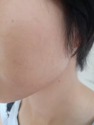 -广州美莱医疗美容医院