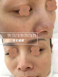 -美肤盾祛痘·问题肌头疗管理中心