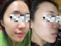 -苏州维多利亚美容医院