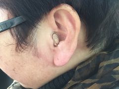 宝山隐形助听器专卖店-宁耳听力助听器奥迪康·峰力·西门子(宝山店)