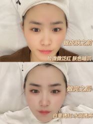 点击看大图 -SKIN79皮肤管理中心