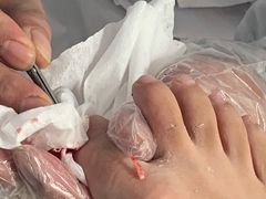 -新甲连锁灰指甲·甲沟炎·鸡眼(黑龙江路店)