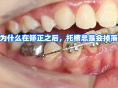-团圆口腔·种植中心(锦江院区)