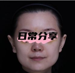 体验后-哈尔滨瑞丽医疗美容医院