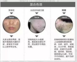 -上海漾颜医疗美容