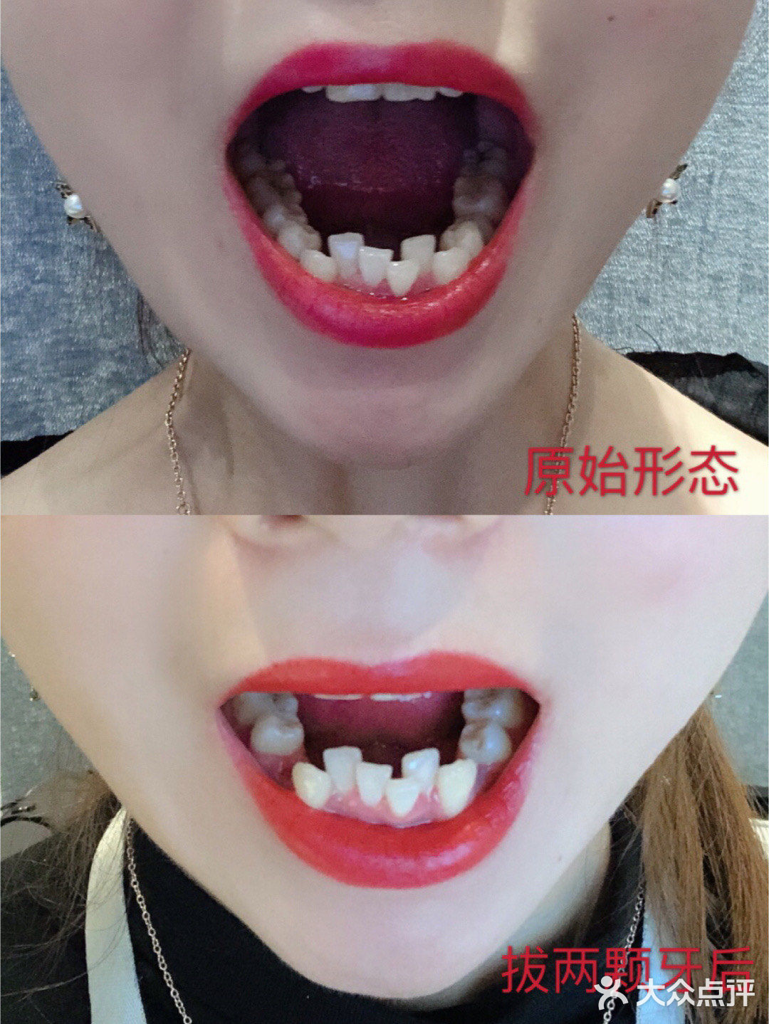 今天很高兴收到了顾客的矫正反馈图