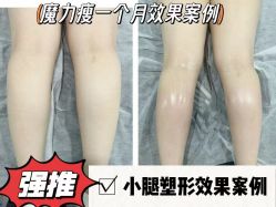 -Lily纤美·科技减脂中心