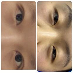 -郡艺医疗美容·微整·眼鼻吸脂