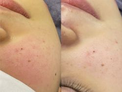 -杉惠素颜美妆皮肤管理中心