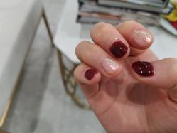 -U-Nail