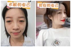 -素美医疗美容·西南眼鼻整形·修复基地