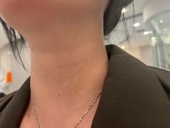 -郡艺医疗美容·微整·眼鼻吸脂