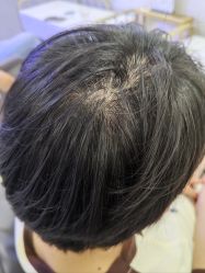 -熙朵美学植发·连锁品牌