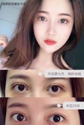 -东莞缔美美容医院