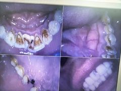 -牙博士口腔品牌连锁(杨浦店)