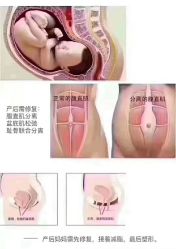 点击看大图 -玛丽亚妇产医院产后修复·医美产康中心