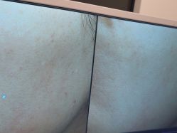 -苑苑vbeauty科技美容SPA