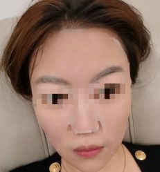 体验后-金圣医疗美容