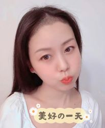 -大麦微针植发全国连锁