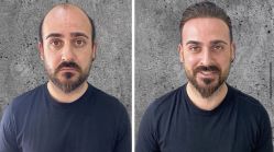 -发饰美男士增发补发假发定制店