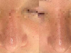 -Flawless skin法思轻奢美肌