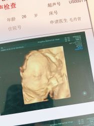 -杭州贝瑞斯美华妇儿医院·早孕·产检·儿科