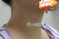 点击看大图 -叶美人医疗美容