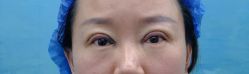 -郑州米兰柏羽集美医疗美容医院
