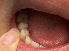 -北京大学口腔医院(第二门诊部)