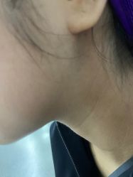 点击看大图 -广州美莱医疗美容医院