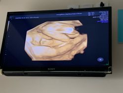 -杭州贝瑞斯美华妇儿医院·早孕·产检·儿科