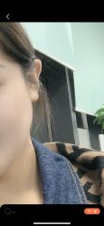 体验前-青岛诺德医学美容医院