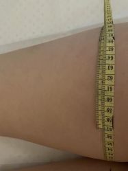 -肥三针腧穴瘦身馆