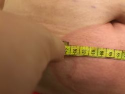 -肥三针腧穴瘦身馆