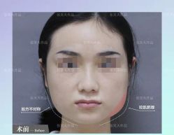 -圣嘉新医疗美容医院