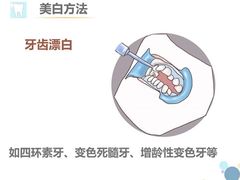 -团圆口腔·种植中心(锦江院区)