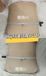 -Lily纤美·科技减脂中心