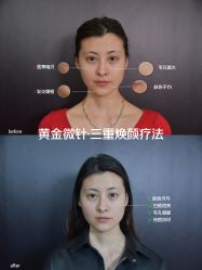 -Yestar艺星整形美容医院
