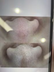 -蕾特恩专业祛痘·皮肤管理