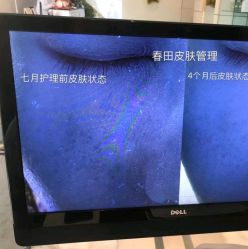 -春田皮肤管理中心品牌旗舰店
