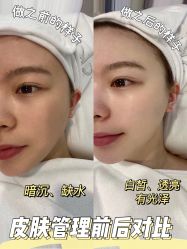 -SKIN79皮肤管理中心