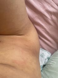 点击看大图 体验后-禾美嘉医疗美容