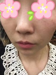 -新美荟医美·专注面部美学抗衰