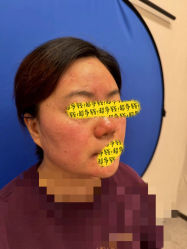 -针美汇欧邦医疗美容