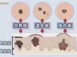 -+MS卓美丝专业祛痘·皮肤管理中心