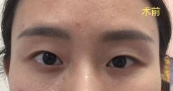 体验前-美莱医学美容医院