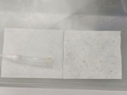 体验后-苗医生草本科技祛痘