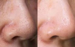 -苑苑vbeauty科技美容SPA