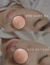 -美愈美肤MEIYU SKIN