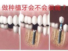 -团圆口腔·种植中心(锦江院区)